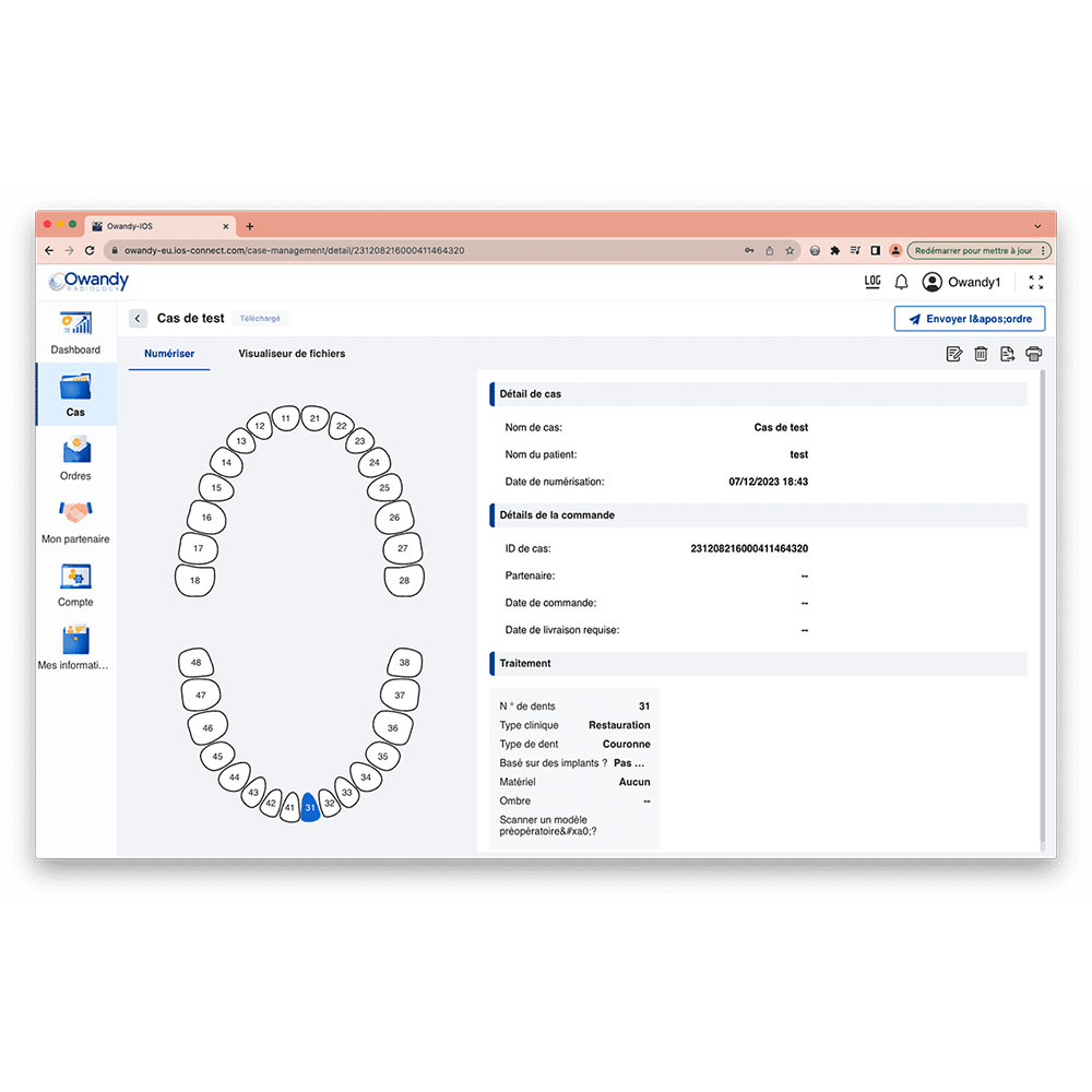 02955_04-Scanner-Intraoral-IOS-Owandy