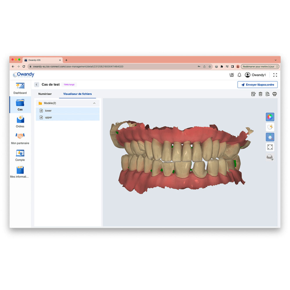 02955_05-Scanner-Intraoral-IOS-Owandy